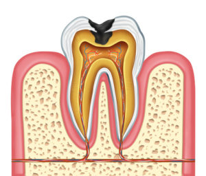 Inner Anatomy of a Cavity