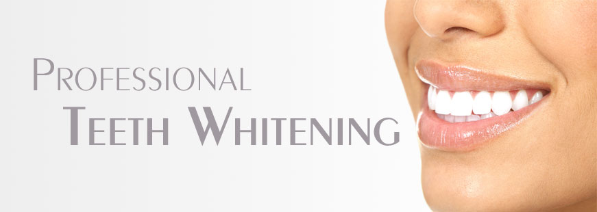 Professional Teeth Whitening