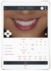 Digital Smile Design on iPad
