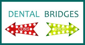 Dental Bridges Pros and Cons