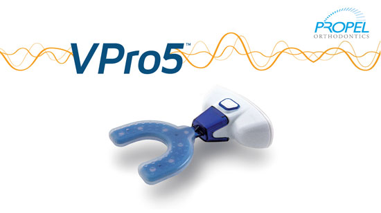 VPro5 Device By Propel Orthodontics