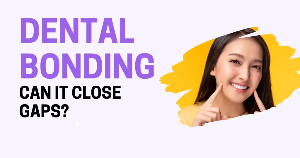 Dental Bonding Gaps Blog Header